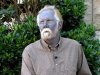 Argyria-Picture.jpg