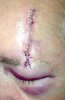 IMG_1193 - Stitches - 14.12.23.jpeg